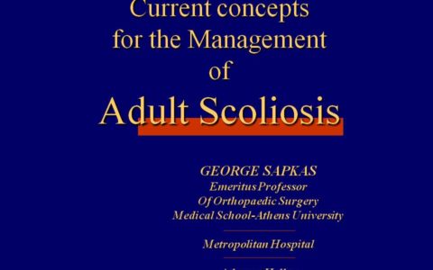 Current concepts for the Management of Adult Scoliosis